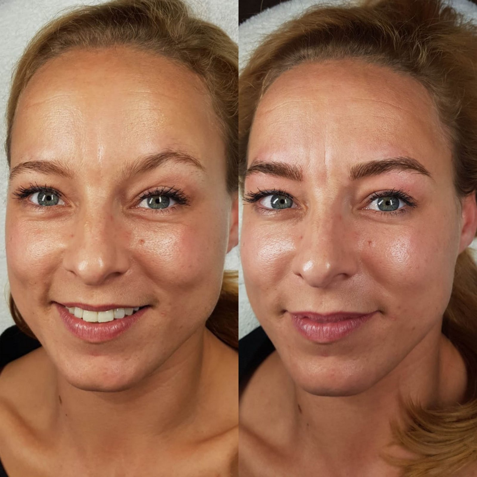 Permanent make-up removal Amsterdam