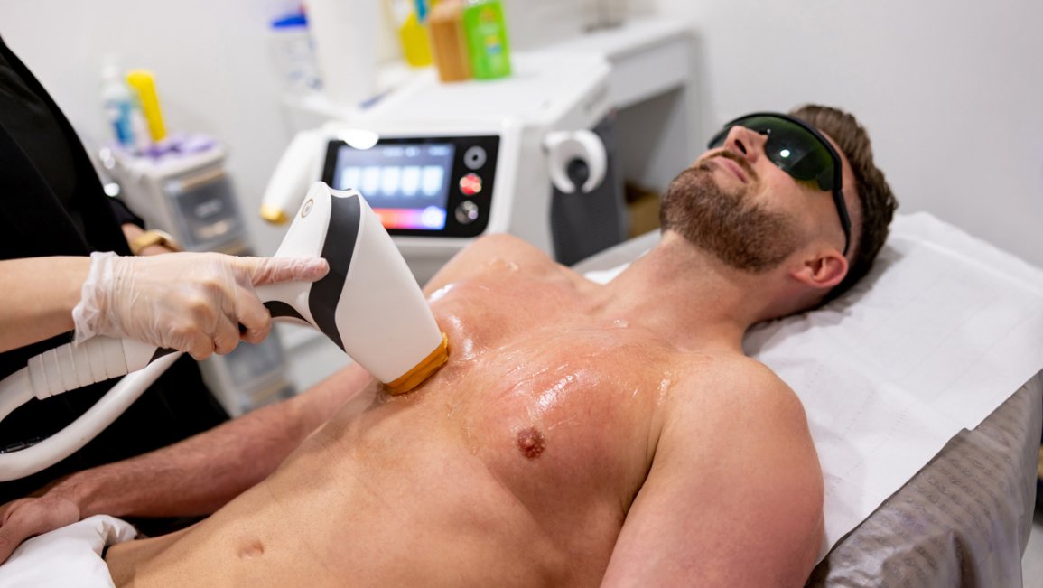 Laser Treatment